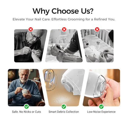 üíÖ‚ú®Universal Automatic Fingernail Grinder for Adults and Childrenüë∂üîß